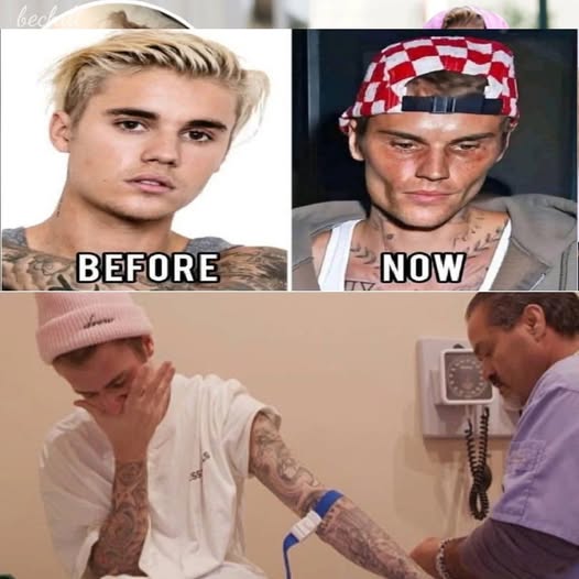 HT9. Justin Bieber admits that he tested positive for…