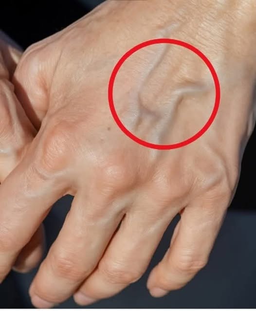 If you have visible veins it means you are…See more
