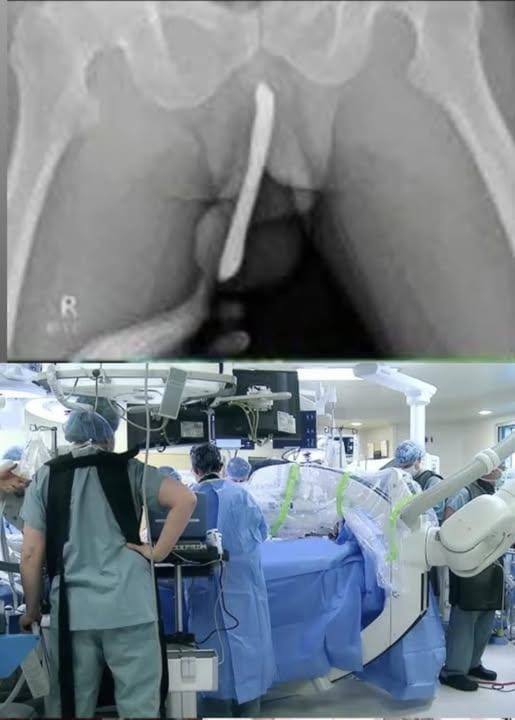 HT10. Girl had to be hospitalized for wanting to use a pe…See more