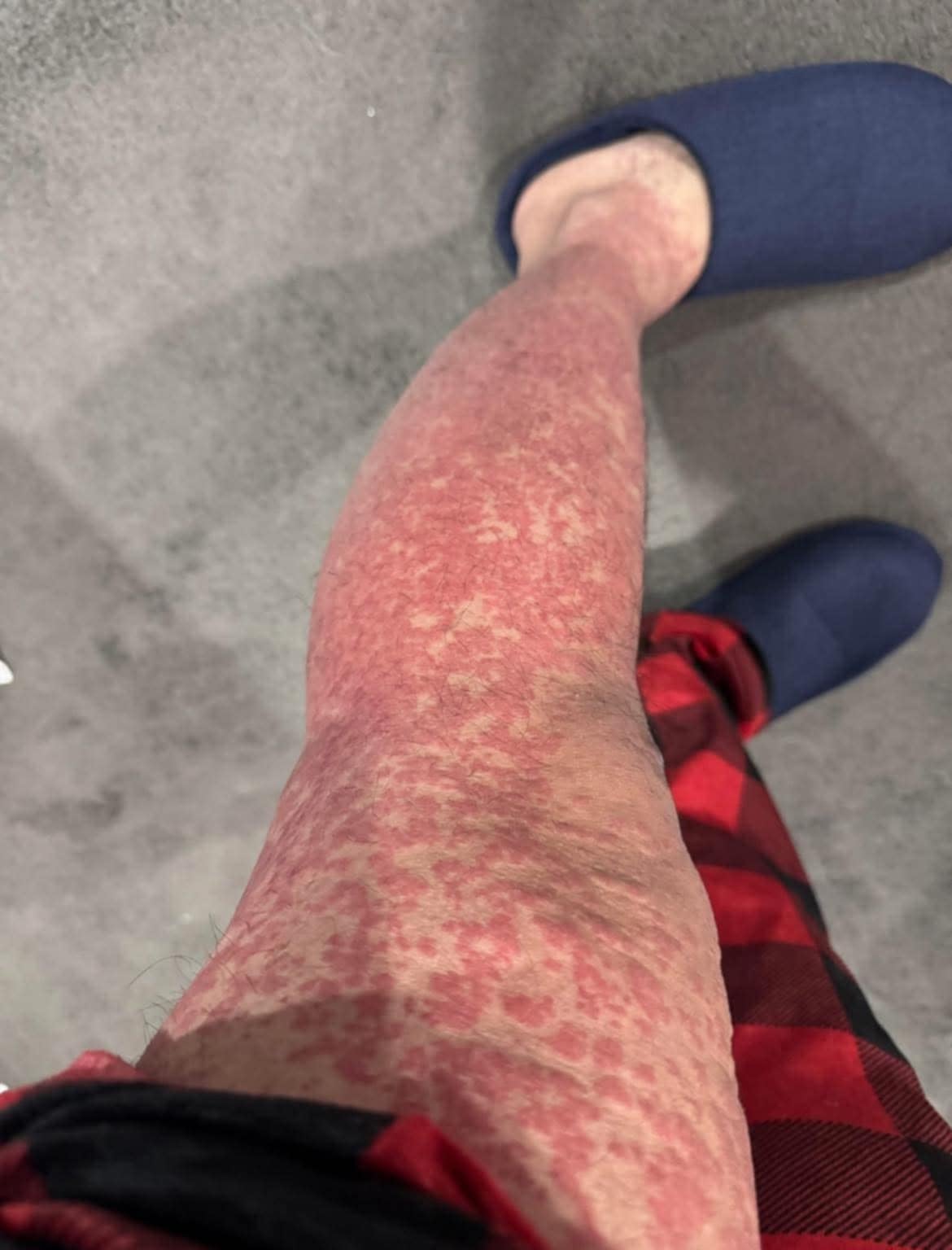 These are the consequences of sleeping with…See more  